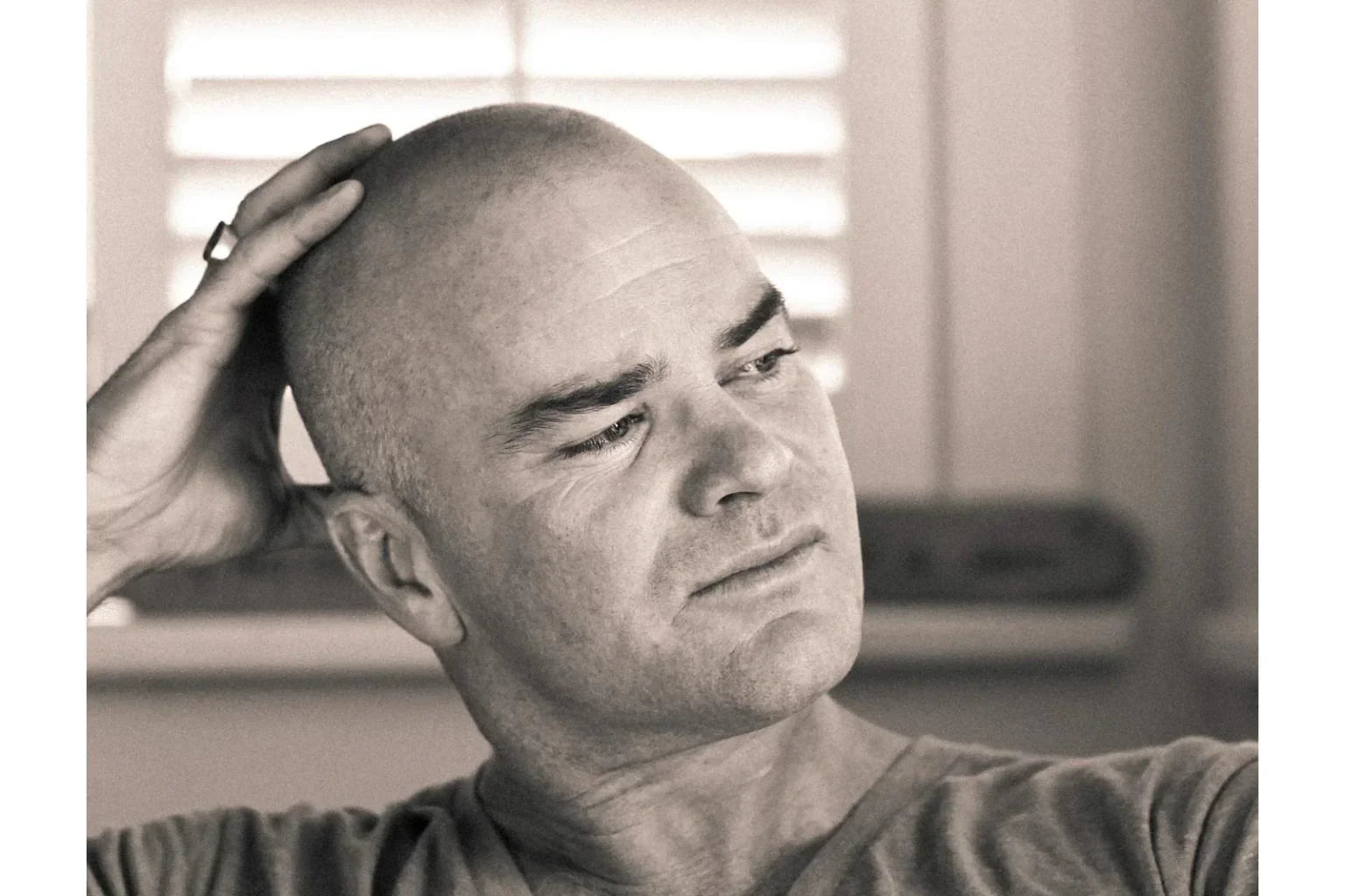 The Bald Truth - it ain't so bad.